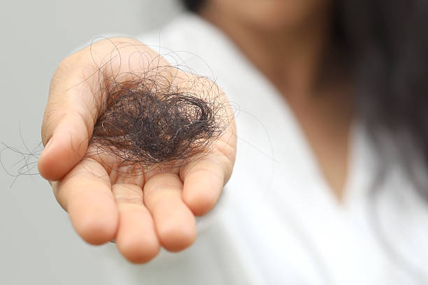 hair loss