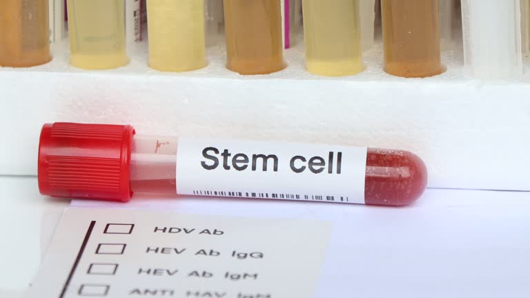 STEM CELL Diagnosis and Evaluation