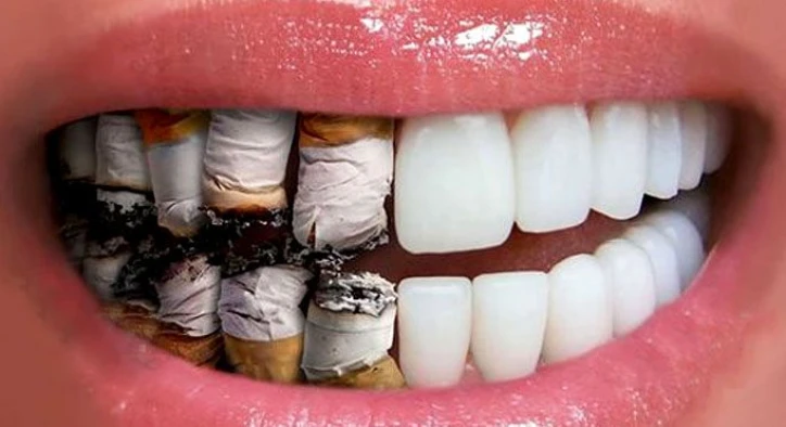dental hygiene